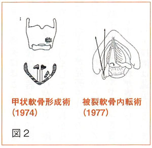 声帯麻痺