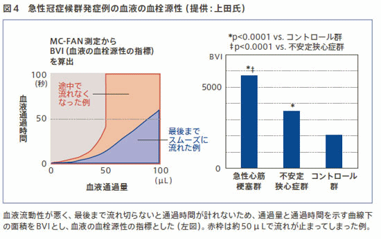 急性冠症と血液血栓源性