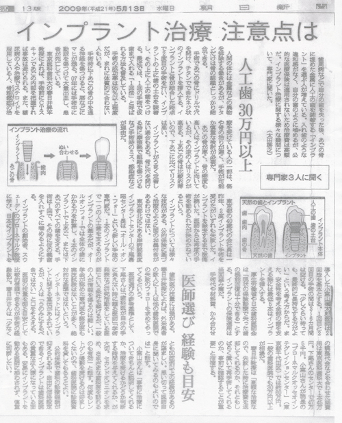 インプラント
